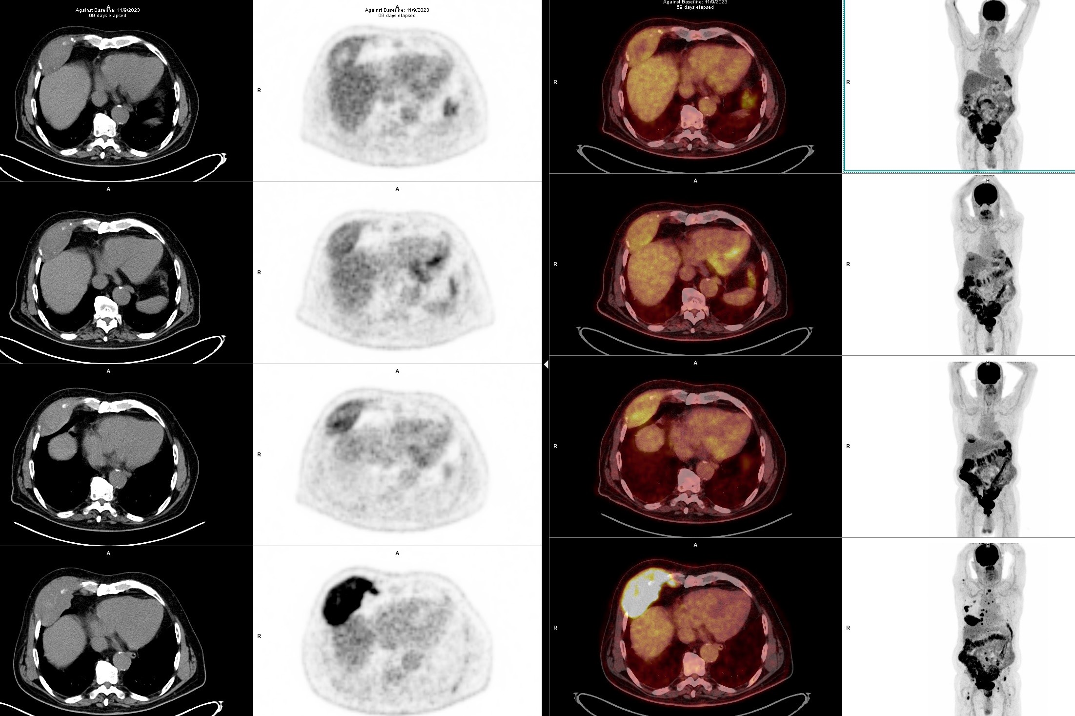 Figure 1a