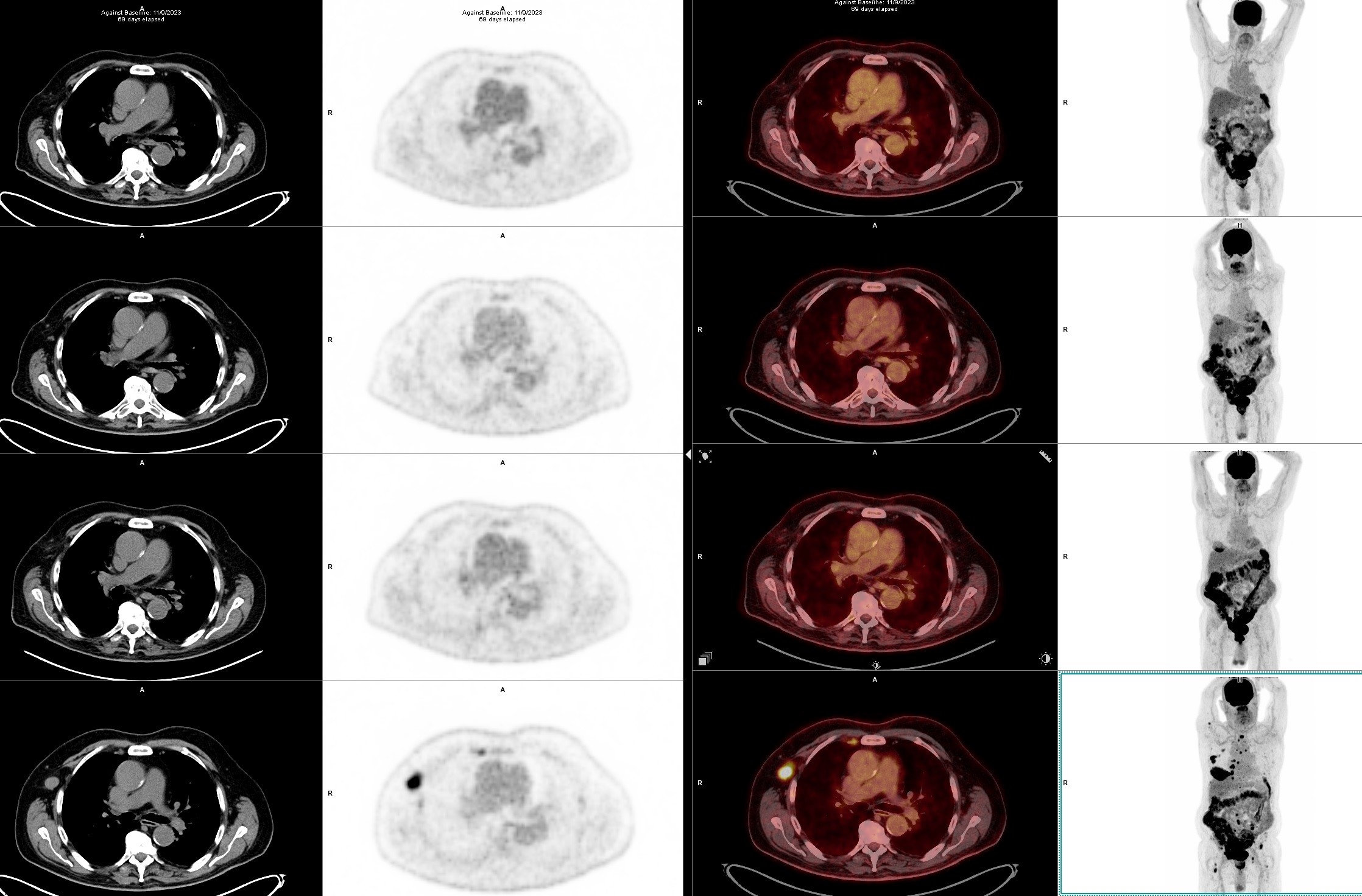 Figure 1b