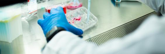 CAR T Cell Therapy