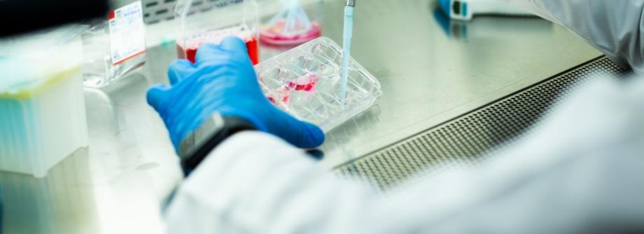 CAR T Cell Therapy